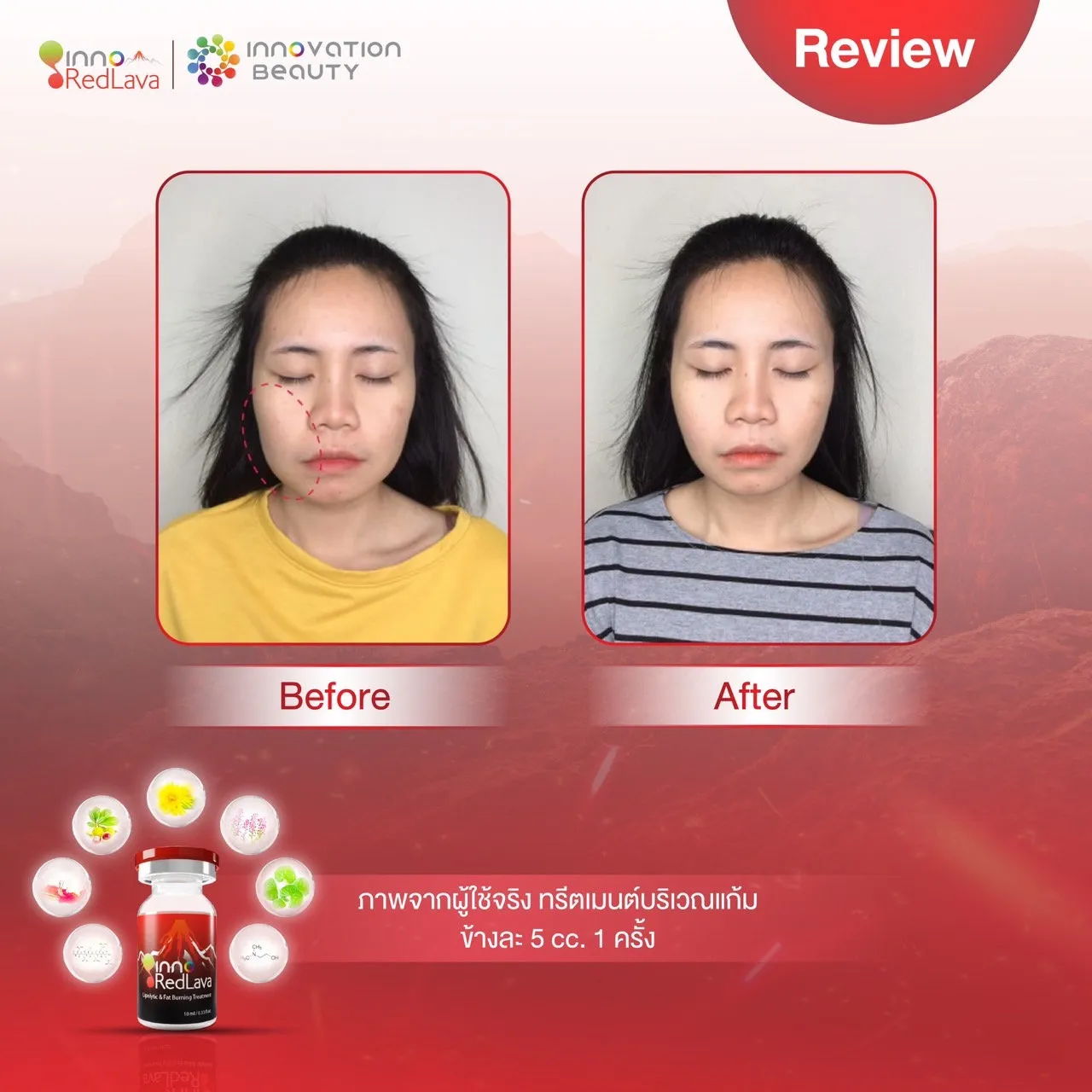 Review Redlava เห็นผลเมื่อไหร่ อยู่ได้นานแค่ไหน