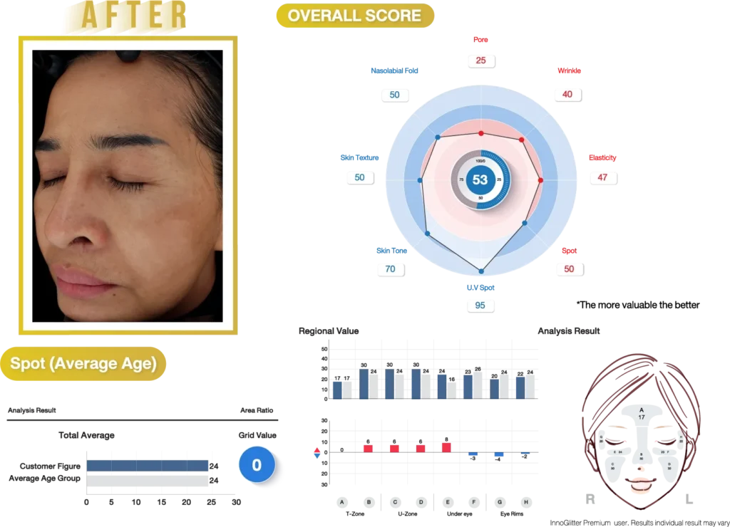 img2_res_ts_glitter_pr