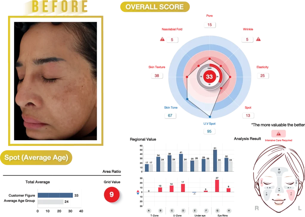 img_res_ts_glitter_pr