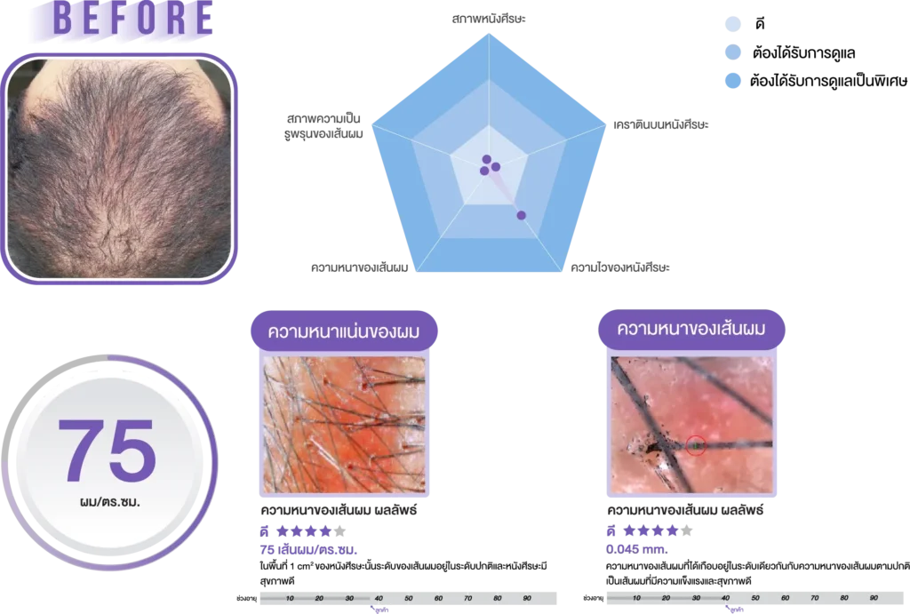 research_before_haira_INNO_IMG