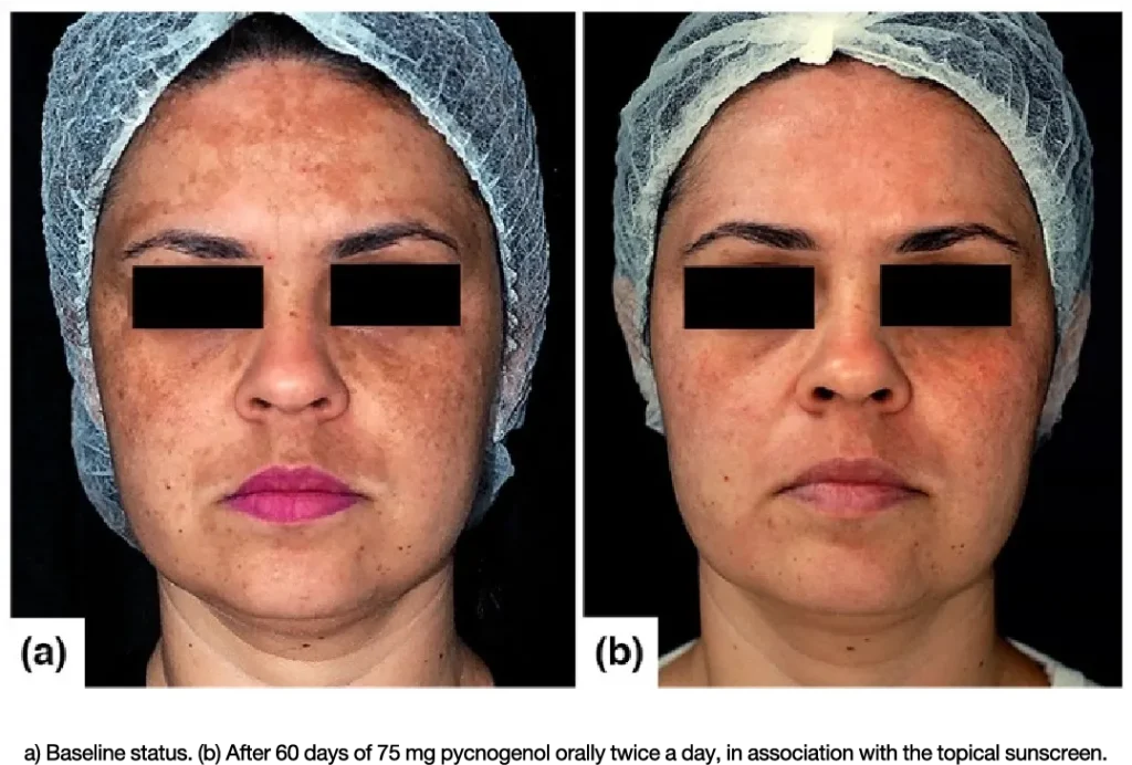 re_img_glitter_premium_1_INNO_IMG