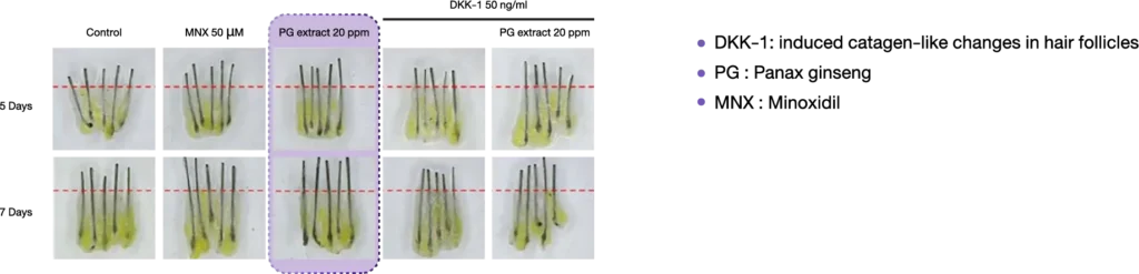 re_img_haira_2_INNO_IMG