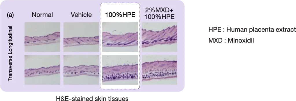 re_img_haira_3_INNO_IMG