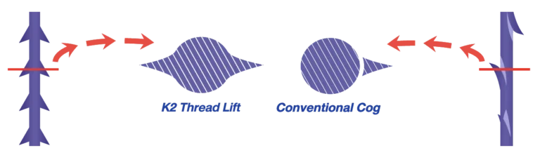 img2_K2 Molding Cog