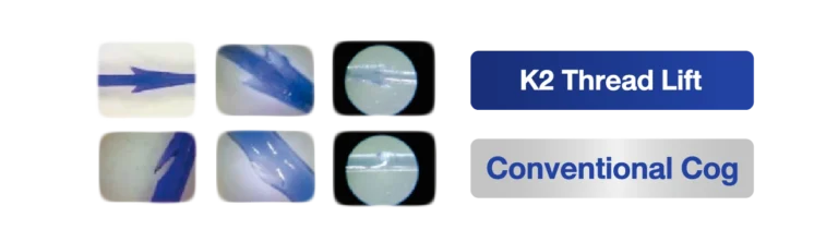 img3_K2 Molding Cog