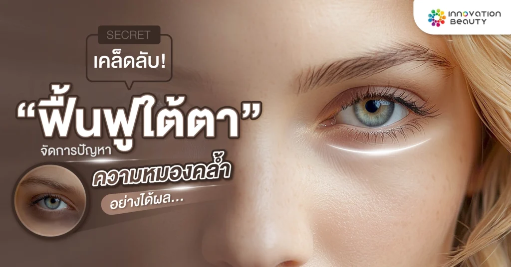 เคล็ดลับ! ฟื้นฟู ใต้ตา จัดการปัญหาความหมองคล้ำอย่างได้ผล
