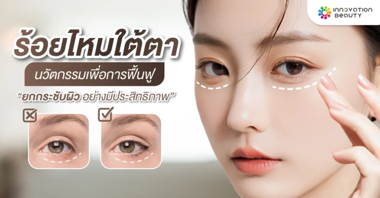 ร้อยไหม ใต้ตา นวัตกรรมเพื่อการฟื้นฟู