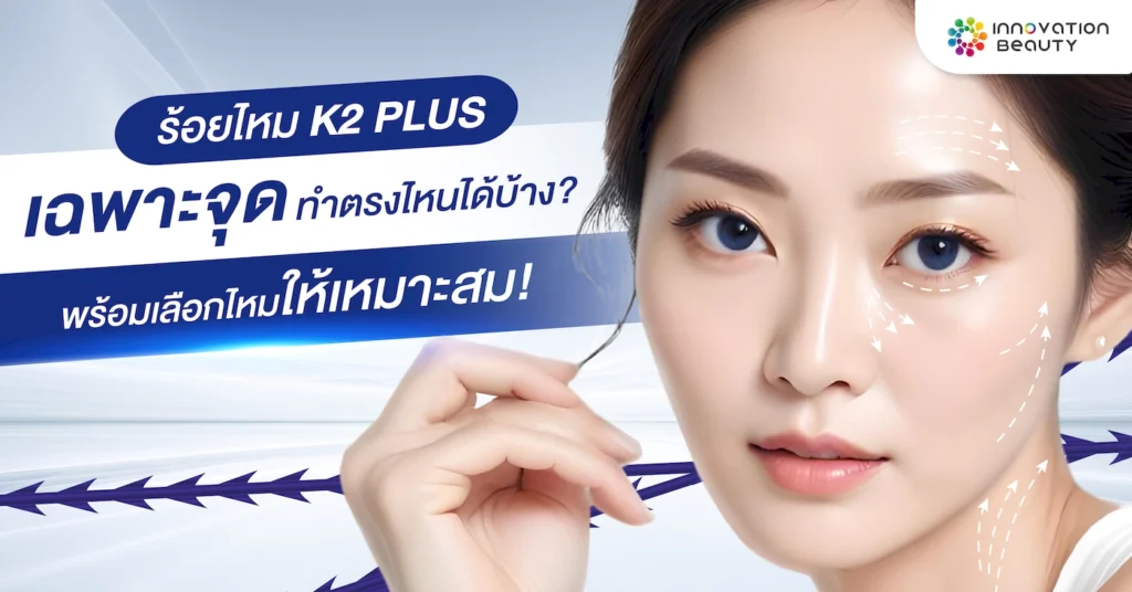 Cover K2 Thread Lift in specific areas-INNO-IMG