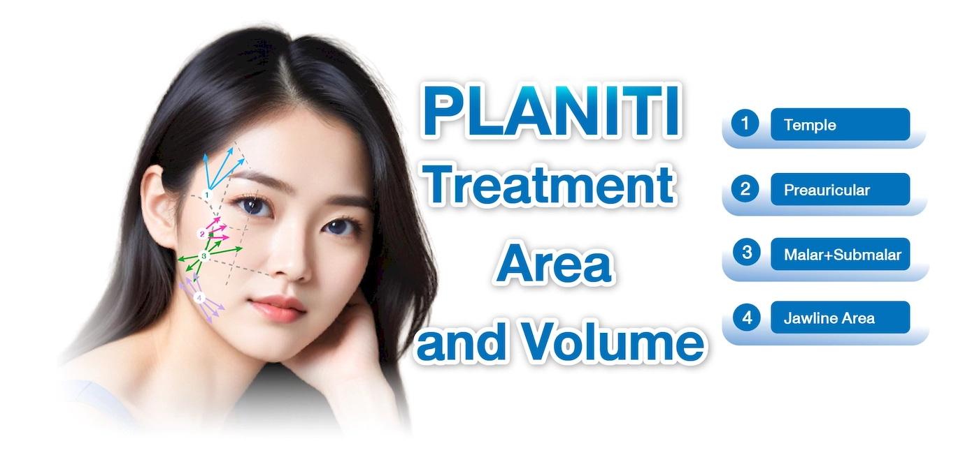PLANITI Area n2