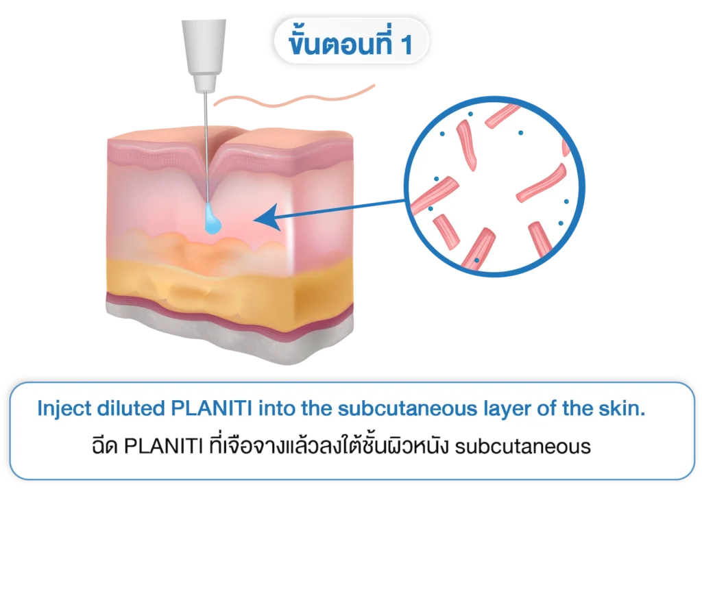 planiti การเตรียมตัวหลังใช้ 1
