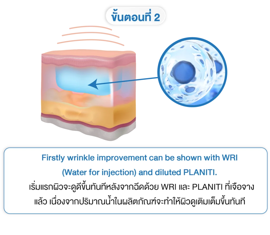 planiti การเตรียมตัวหลังใช้ 2-INNO-IMG