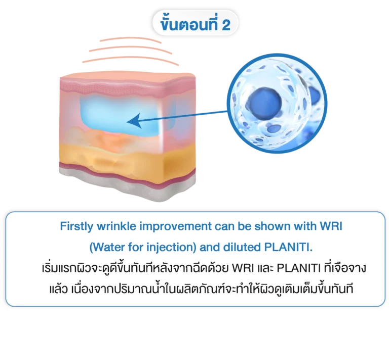 planiti การเตรียมตัวหลังใช้ 2-INNO-IMG