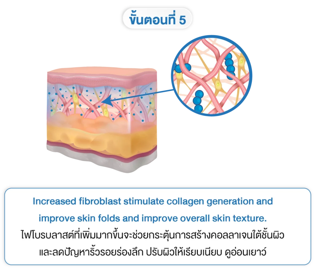 planiti การเตรียมตัวหลังใช้ 5-INNO-IMG