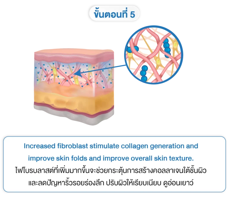planiti การเตรียมตัวหลังใช้ 5-INNO-IMG