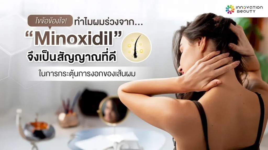 ทำไมผมร่วงจาก Minoxidil