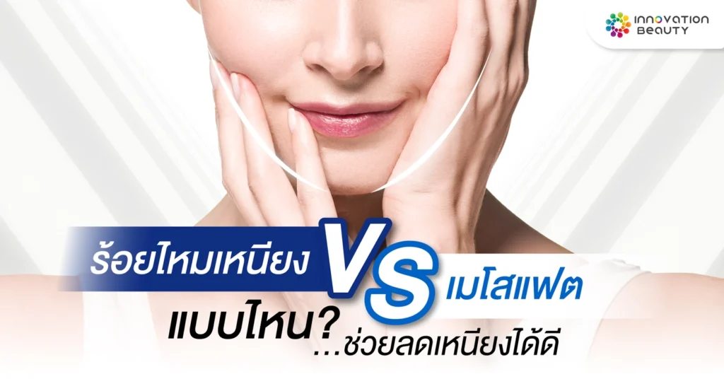 ร้อยไหมเหนียง VS เมโสแฟต แบบไหนช่วยลดเหนียงได้ดีกว่ากัน?
