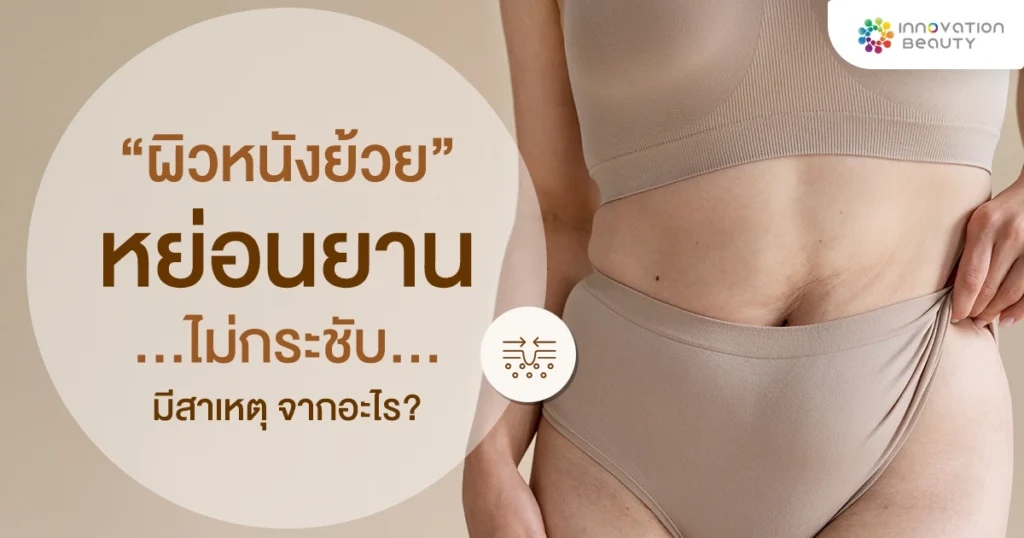 “ผิวหนังย้วย” หย่อนยาน ไม่กระชับ มีสาเหตุ จากอะไร ?