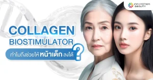Collagen Biostimulator ทำไมถึงช่วยให้หน้าเด็กลงได้?