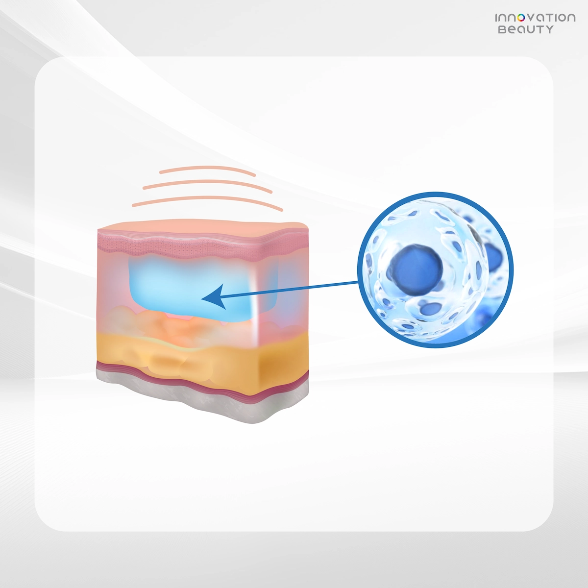 ประเภทของสาร Biostimulator ที่ได้รับความนิยม