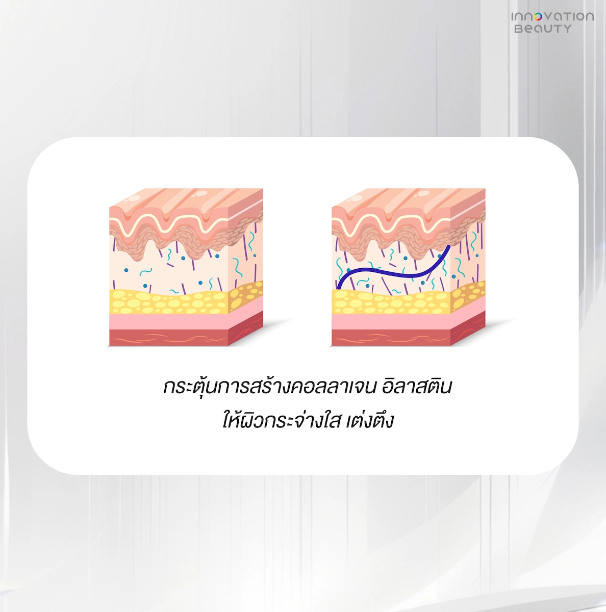 การทำงานของไหม Mono (k2 Mono)