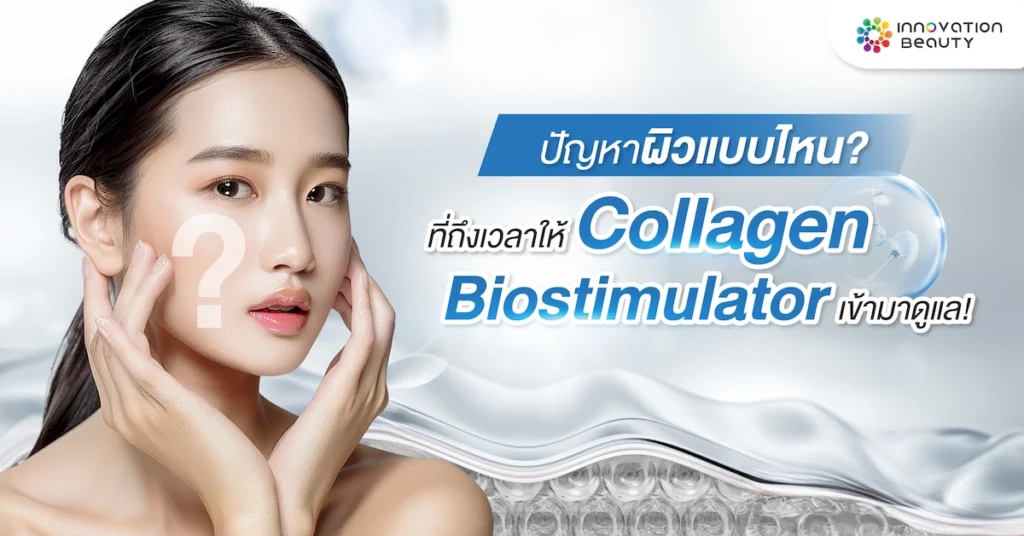 ปัญหาผิวแบบไหนที่ต้องถึงเวลาให้ Collagen Biostimulator เข้ามาดูแล!