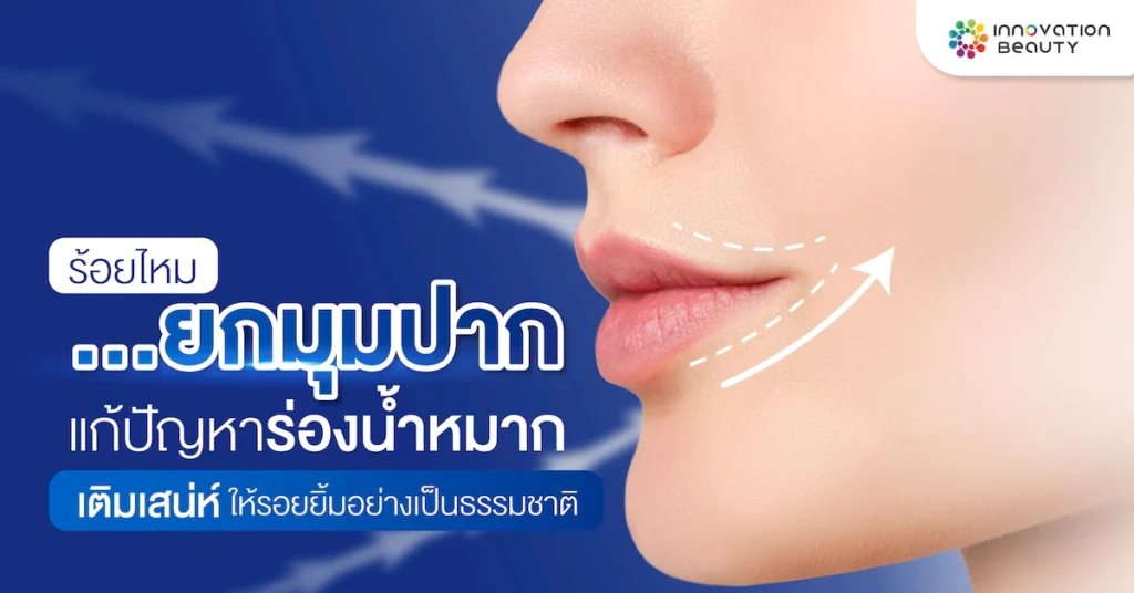 ร้อยไหมยกมุมปาก แก้ปัญหาร่องน้ำหมาก เติมเสน่ห์ให้รอยยิ้มอย่างเป็นธรรมชาติ