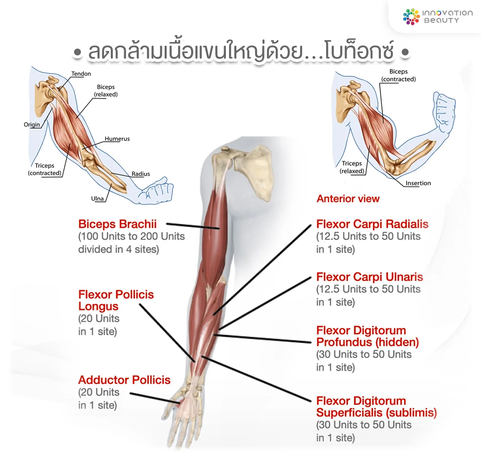 ลดกล้ามเนื้อแขนใหญ่ด้วย โบท๊อกซ์