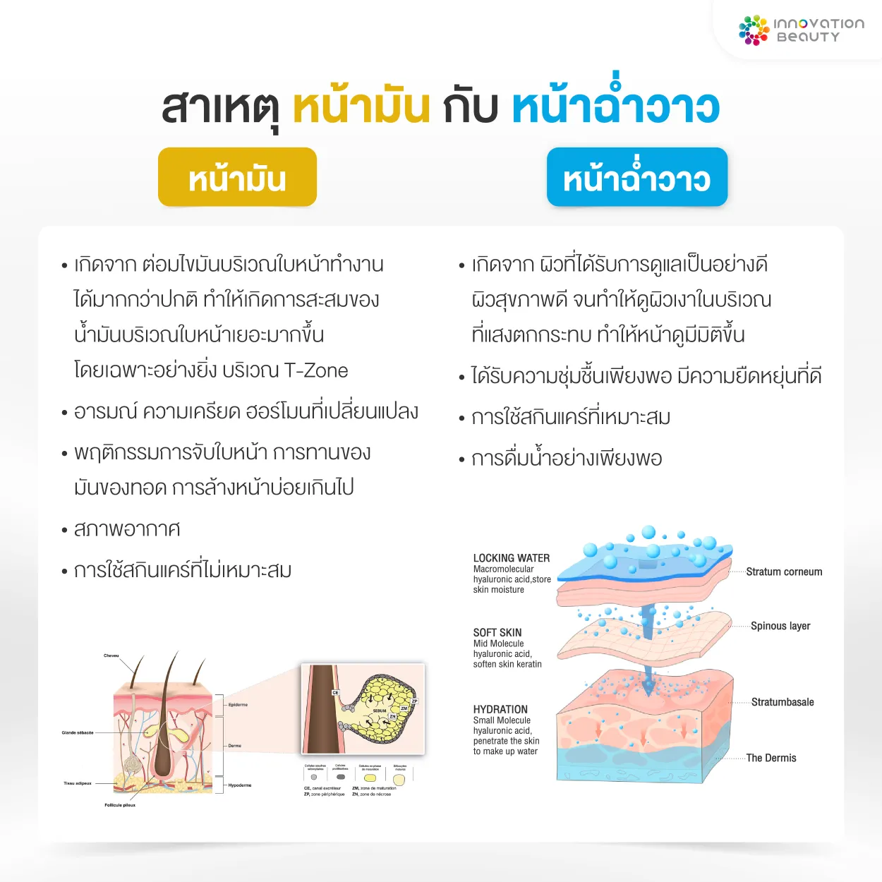 สาเหตุ หน้ามัน Vs หน้าฉ่ำวาว