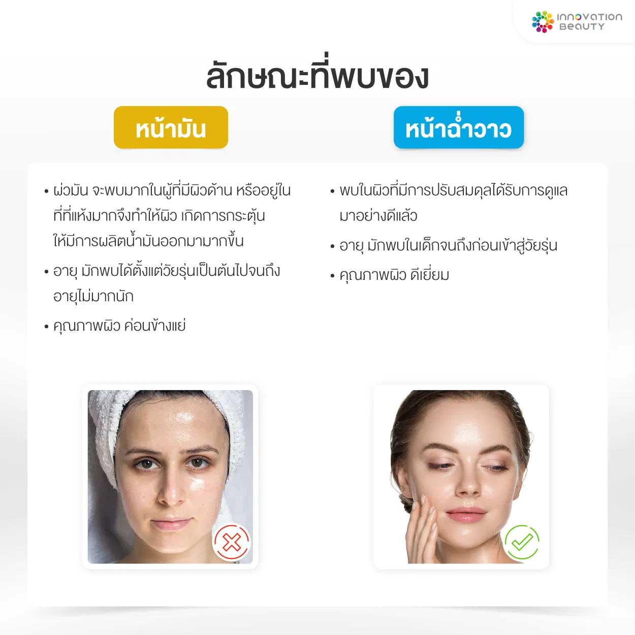 ลักษณะที่พบของ หน้ามัน Vs หน้าฉ่ำวาว