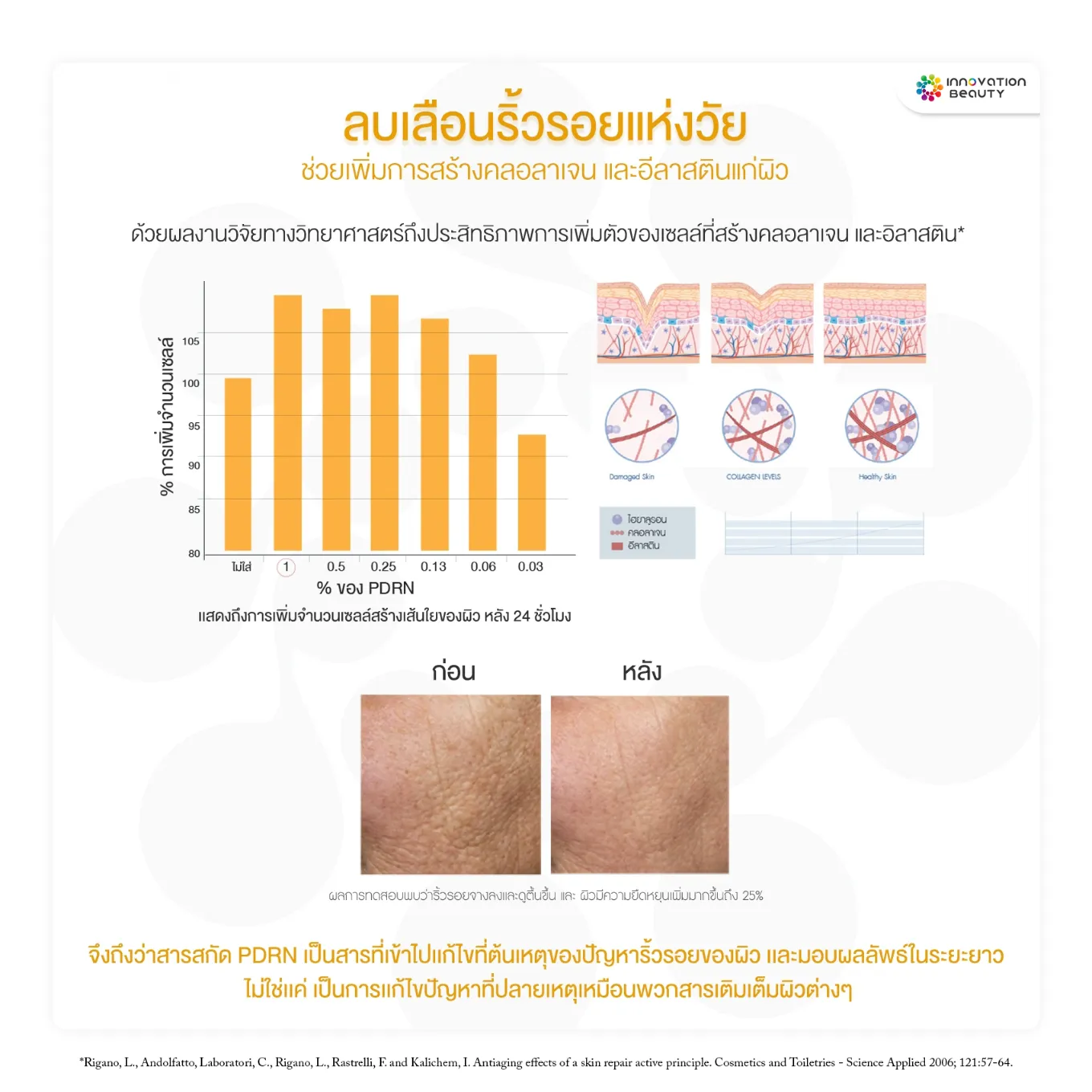 สารสกัด PDRN หรือ Polydeoxyribonucleotide ช่วยเรื่อง ลบเลือนริ้วรอยแห่งวัย