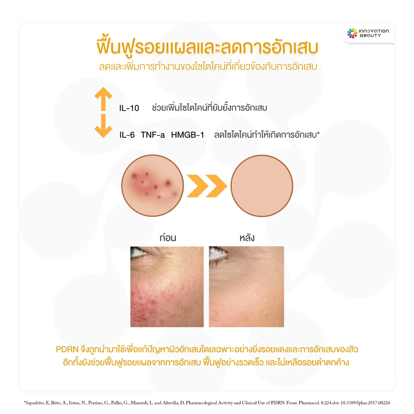 สารสกัด PDRN หรือ Polydeoxyribonucleotide ช่วยเรื่องฟื้นฟูรอยแผลและลดการอักเสบ