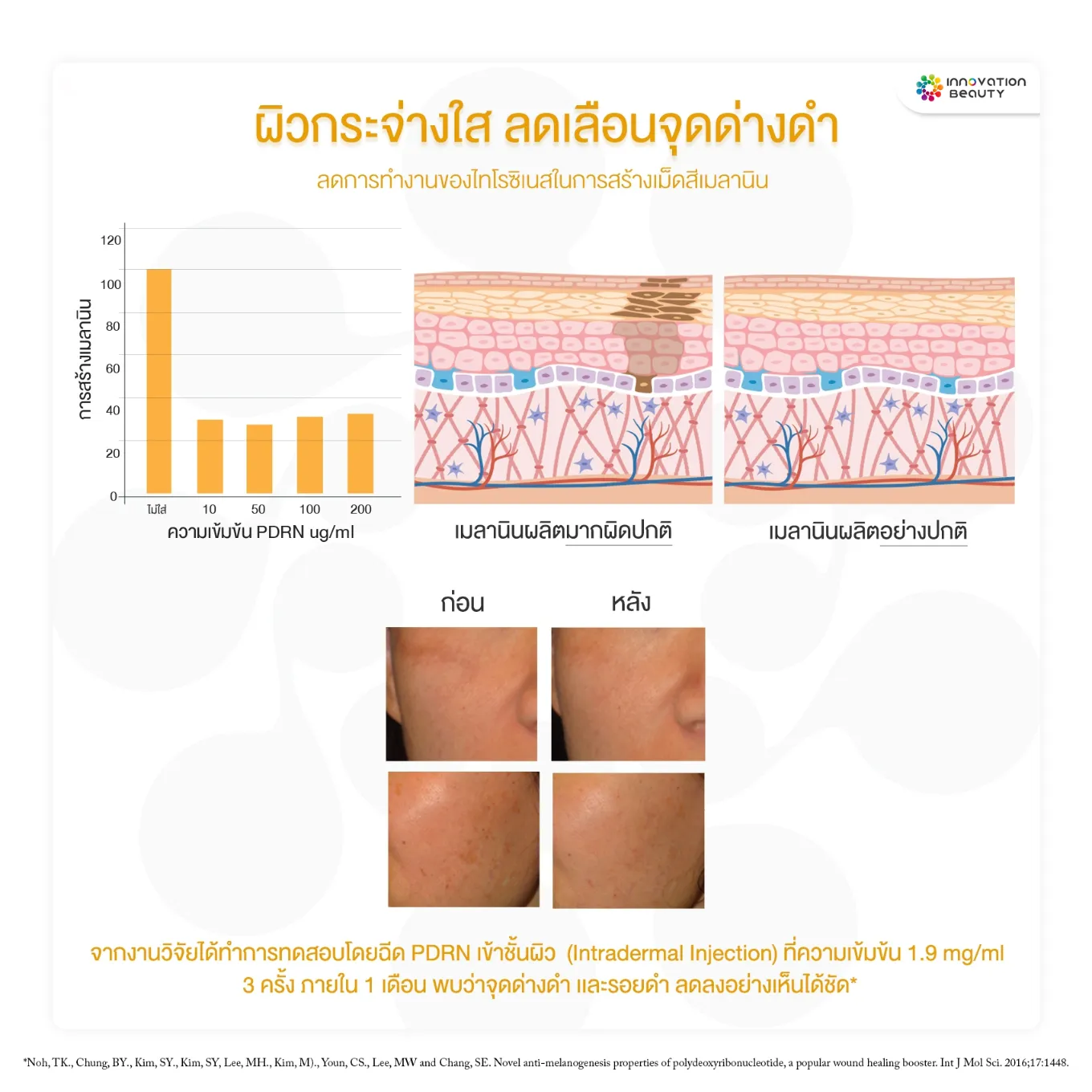 สารสกัด PDRN หรือ Polydeoxyribonucleotide ช่วยเรื่องผิวกระจ่างใส ลดเลือนจุดด่างดำ