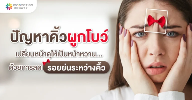 "ปัญหาคิ้วผูกโบว์" เปลี่ยน ริ้วรอยบนใบหน้า จากหน้าดุให้เป็นหน้าหวาน