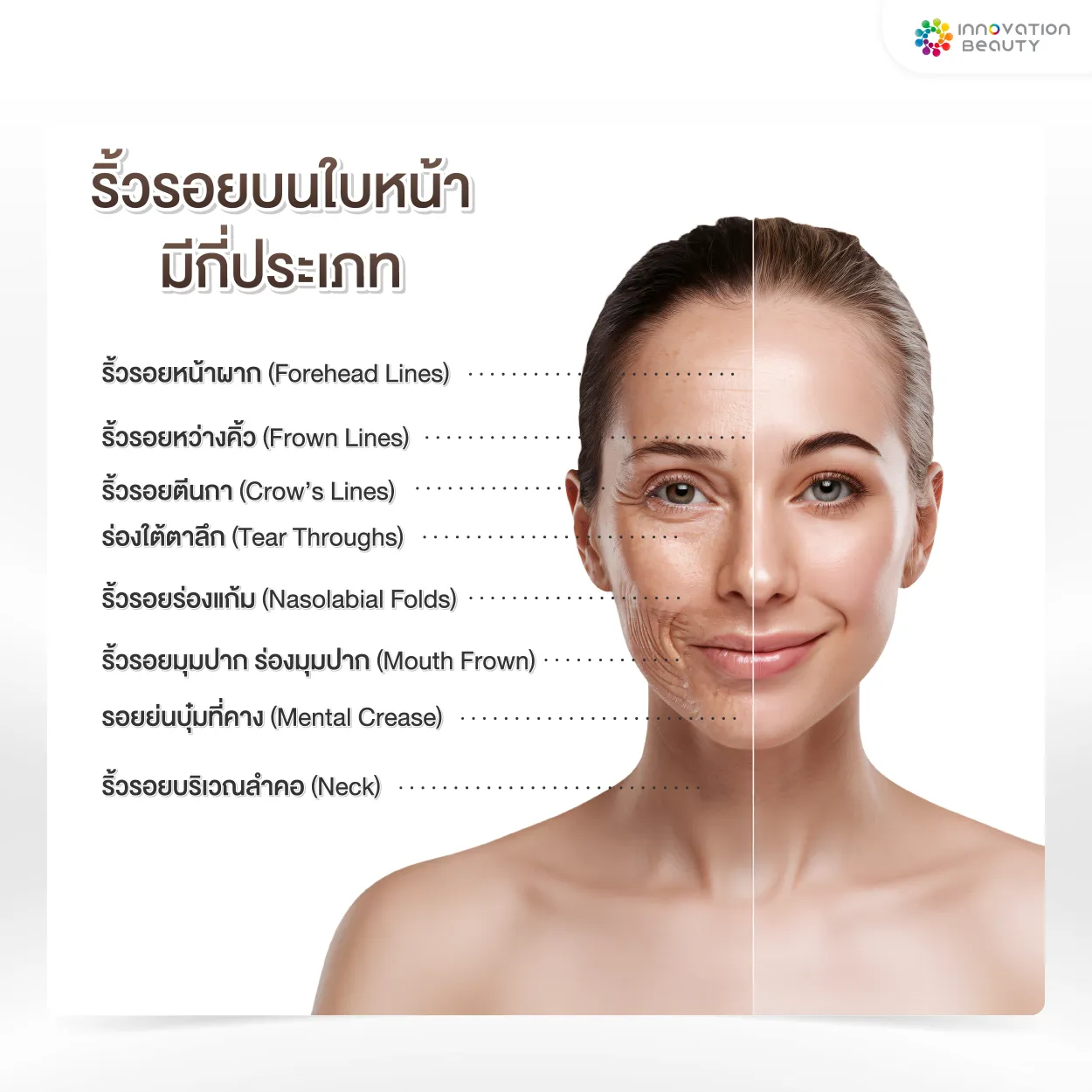 ริ้วรอยบนใบหน้า มีกี่ประเภท?