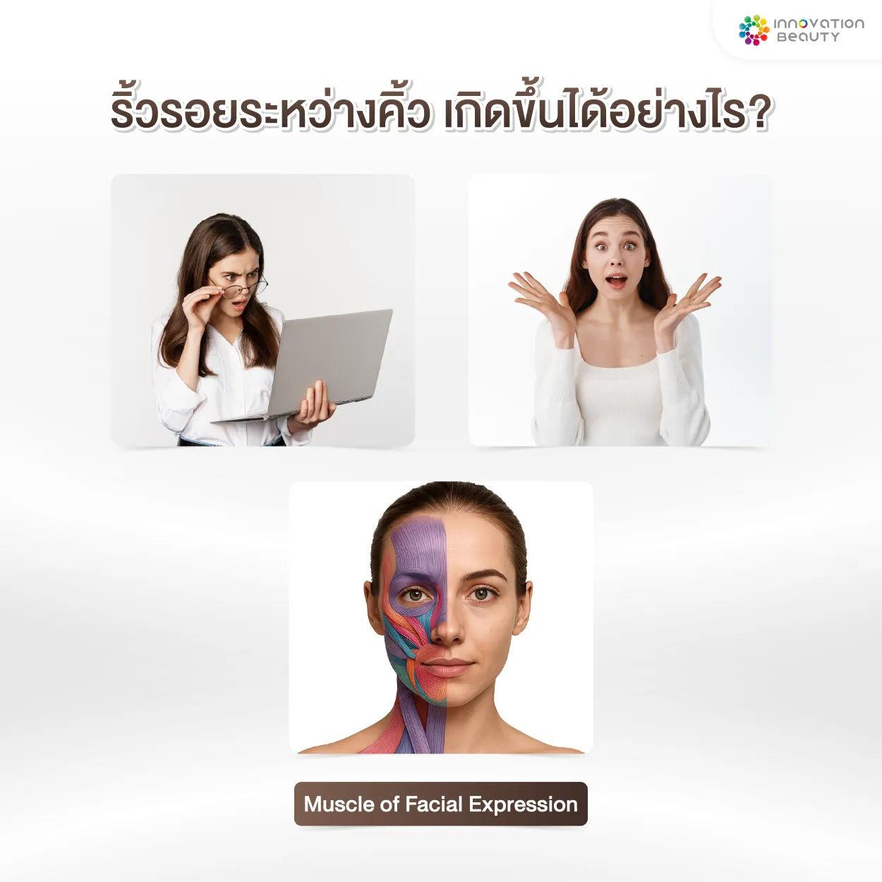 ริ้วรอยระหว่างคิ้ว เกิดขึ้นได้อย่างไร