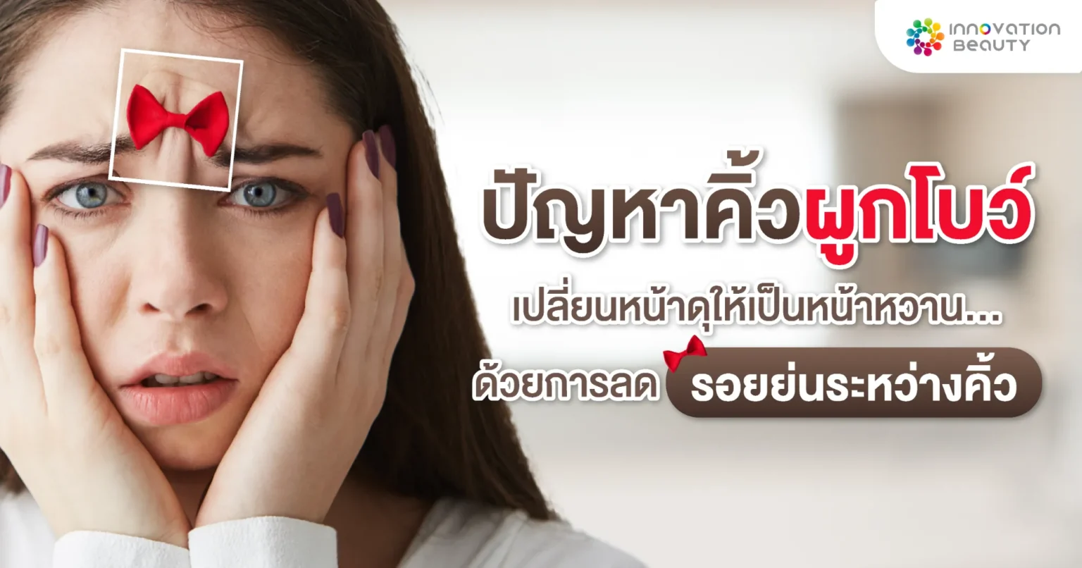 "ปัญหาคิ้วผูกโบว์" เปลี่ยน ริ้วรอยบนใบหน้า จากหน้าดุให้เป็นหน้าหวาน