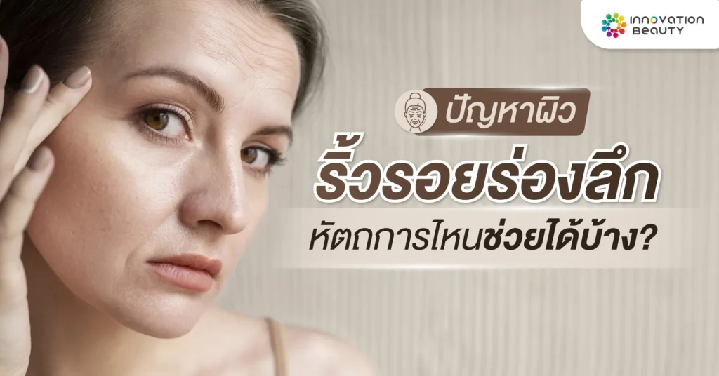 ปัญหาผิวริ้วรอยร่องลึก หัตถการไหนช่วยได้บ้าง?