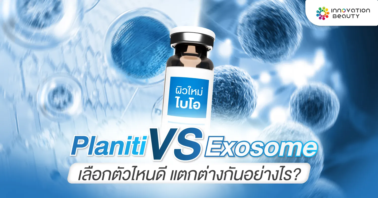 Planiti vs Exosome เลือกตัวไหนดี! แตกต่างกันอย่างไร?