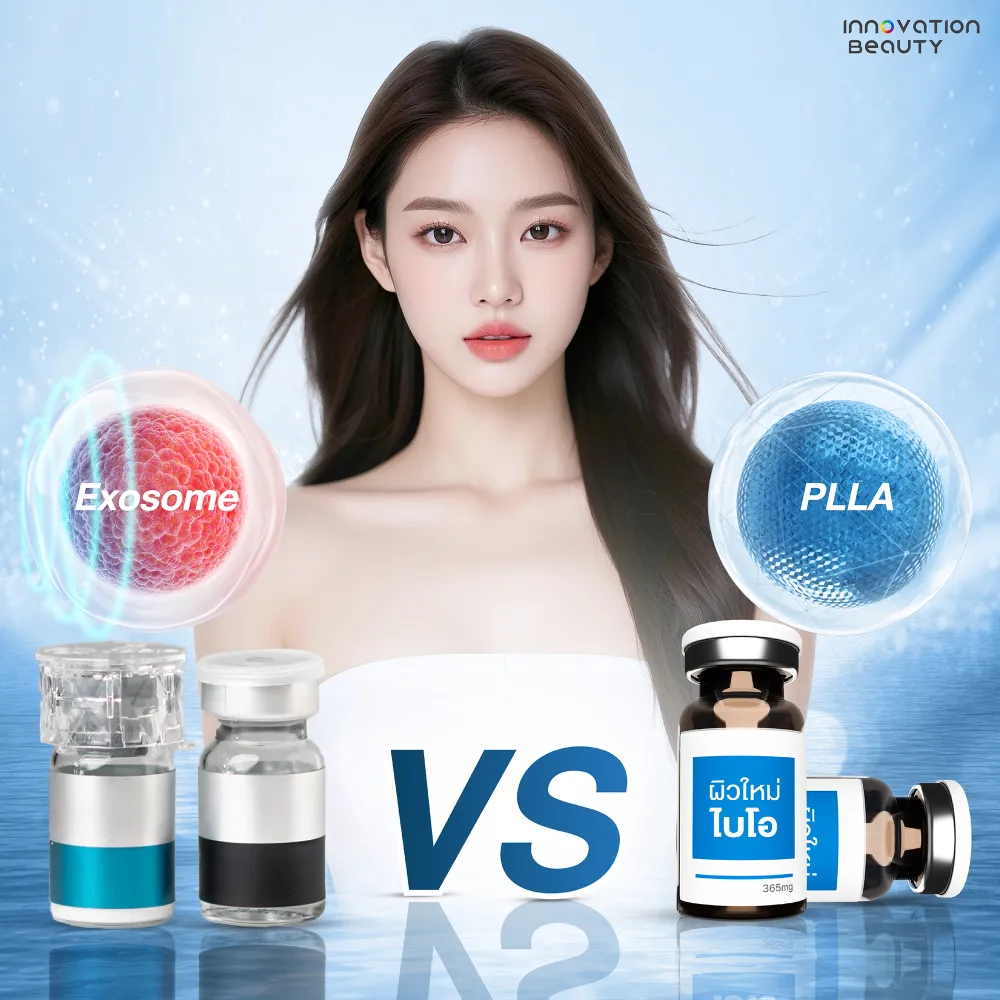 Planiti vs Exosome เหมาะกับใคร?
