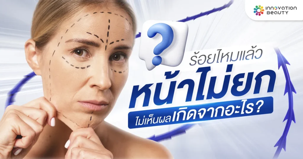 ร้อยไหมแล้วหน้าไม่ยก ไม่เห็นผลเกิดจากอะไร?