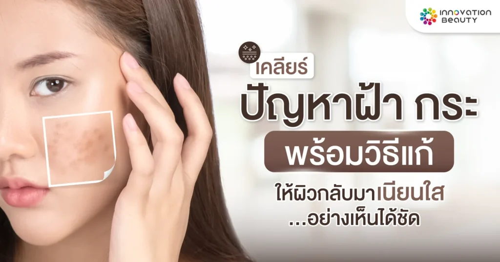 เคลียร์ปัญหา ฝ้า กระ พร้อมวิธีแก้ให้ผิวกลับมาเนียนใส