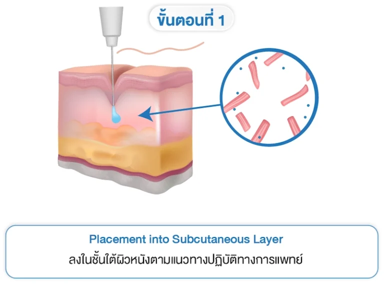 Treatment Principle 1