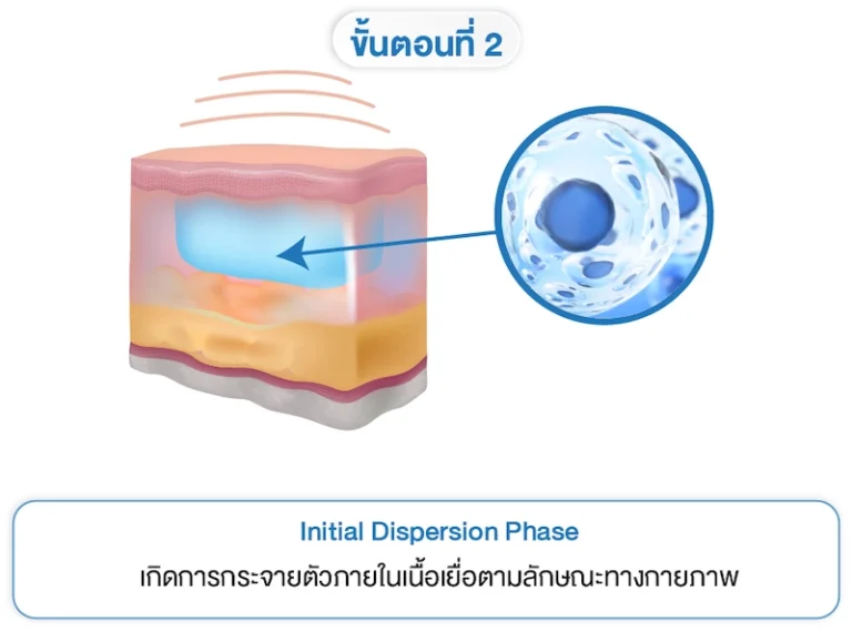 Treatment Principle 2