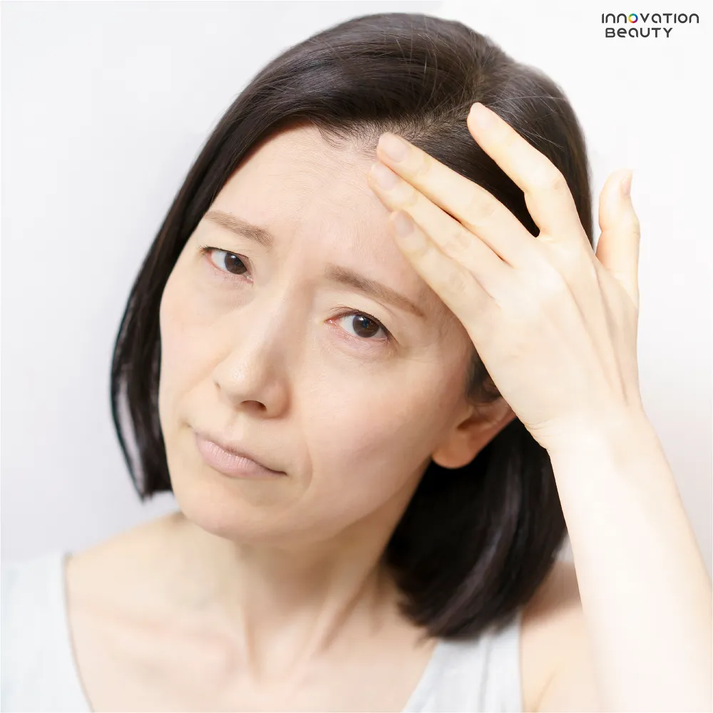 ปัจจัยอะไรที่ทำให้เกิดปัญหาผิวในอายุ 35+