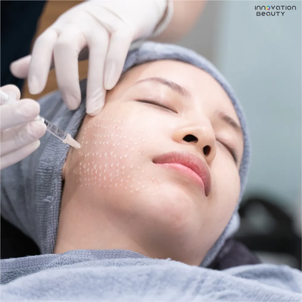 โปรแกรมงานผิวเมโสเทอราปี (Mesotherapy)