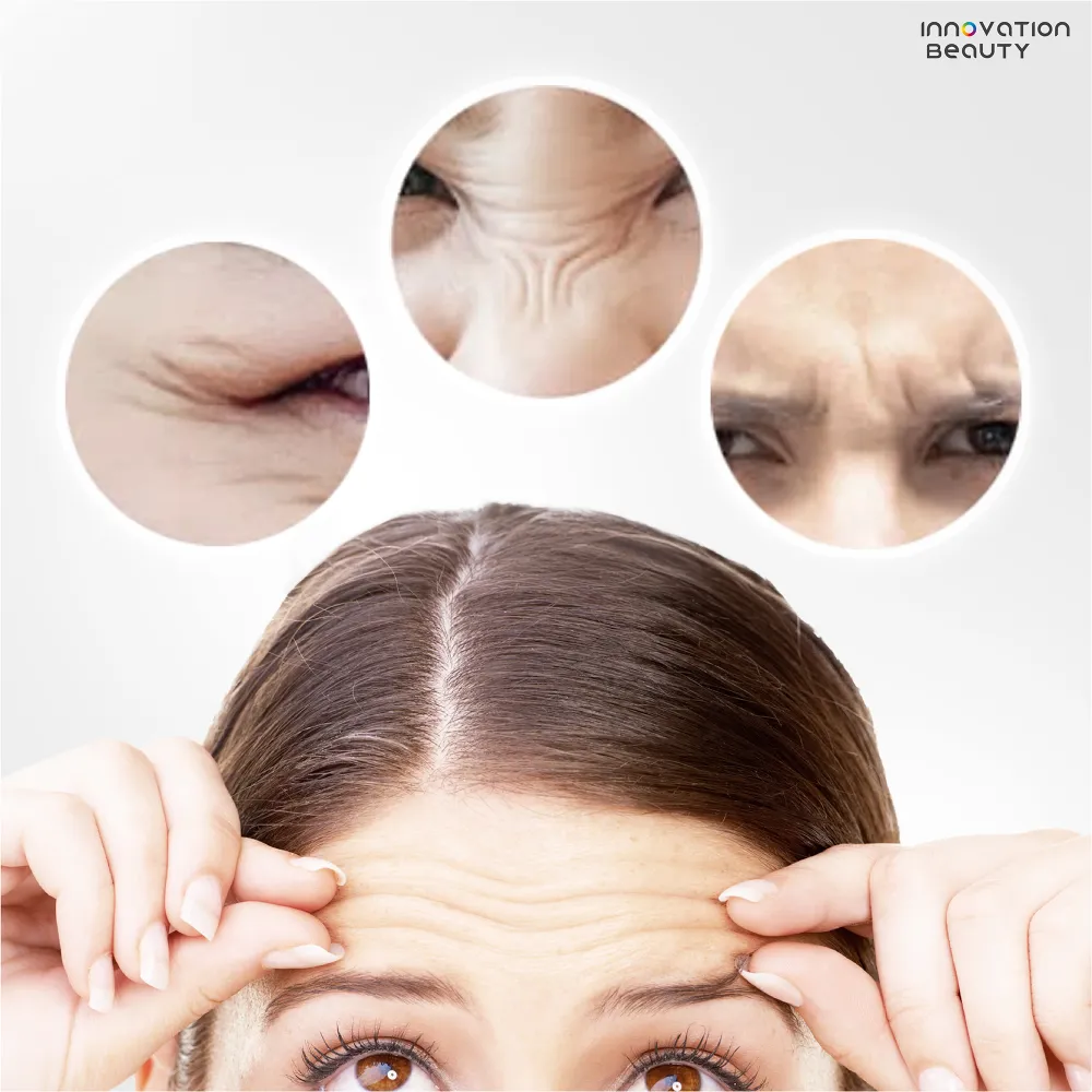 ผิวในอายุ 35+ มีลักษณะอย่างไร?