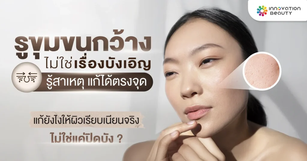 รูขุมขนกว้าง ไม่ใช่เรื่องบังเอิญ รู้สาเหตุ แก้ได้ตรงจุด