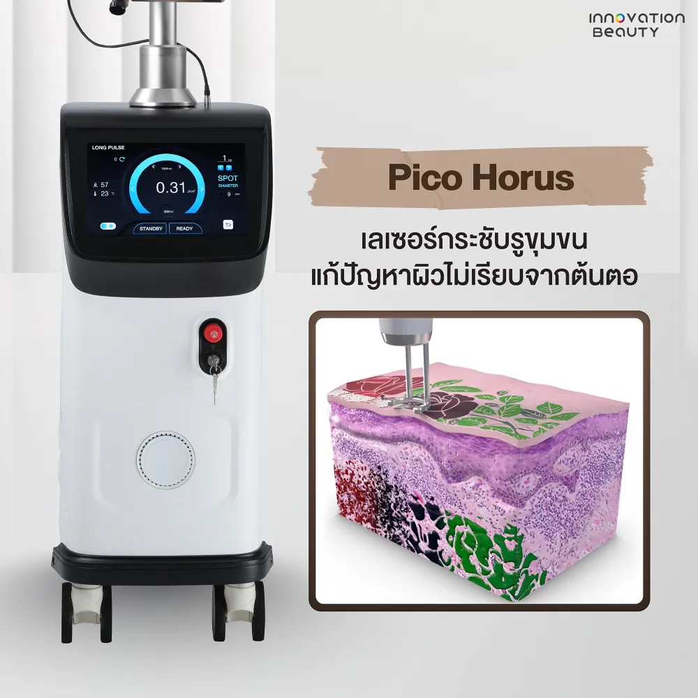 Pico Horus เลเซอร์กระชับรูขุมขน แก้ปัญหาผิวไม่เรียบจากต้นตอ