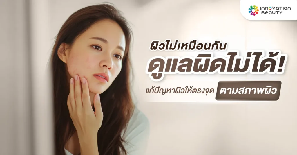 ผิวไม่เหมือนกัน ดูแลผิดไม่ได้! แก้ปัญหาผิวให้ตรงจุดตามสภาพผิว