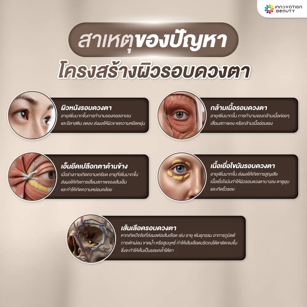 สาเหตุของปัญหา โครงสร้างผิวรอบดวงตา 